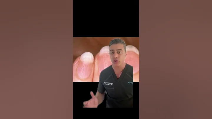 What your nails say about your health? - Rippled Nails