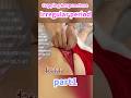 【cupping acupuncture】生理不順　吸い玉　整体鍼治療　Irregular Period #吸い玉