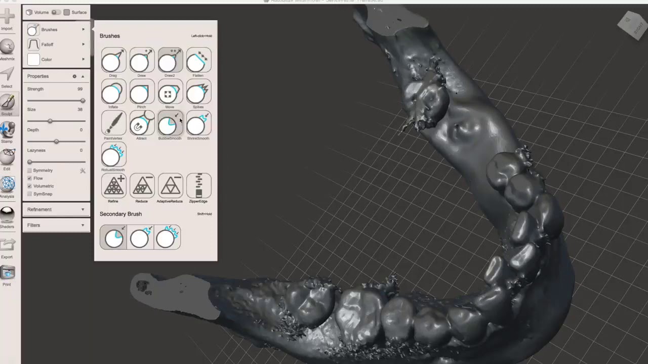 Fabricating a Zirconia Membrane for Ridge Augmentation Using Meshmixer