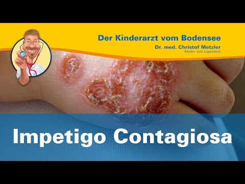 Video: Impetigo - Vulgäre Impetigo, Symptome Und Behandlung