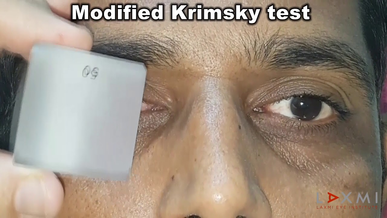 Laxmi Eye Education presents - measurement of deviation and diagnosing the type of squint