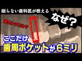【歯周病 重大トラブル発見か？】口腔内の3Dスキャン、レントゲン、歯周ポケットと歯茎検査、唾液検査の結果から40代男性の歯周病、虫歯リスクを丸裸にする。