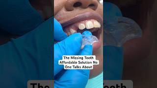The Missing Tooth Secret Dentists Don’t Talk About 😳
