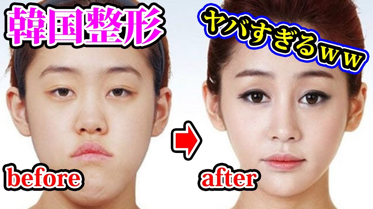 韓国の激安整形で顔を変えた人たちがヤバイｗｗｗ【都市伝説】【坂口杏里】