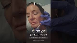 Radiesse Jawline Refinement
