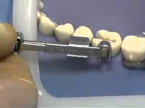 How To Place Matrix Band In Tofflemire Retainer Low Youtube How To Place Matrix Band In Tofflemire Retainer Low Youtube