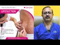 Liposuction Procedure | Liposuction Surgeon in Bangalore  - Dr. Girish AC