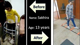 13-Years-Old Girl Polyneuropathy Patient, Life-Changing Case Polyneuropathy Physical Therapy