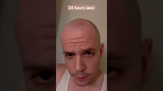 24 hours after shaving