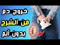 أسباب خروج دم من الشرج بدون ألم