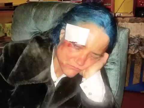 The Doug Stanhope Podcast - Doug's Tin Can Rehab - Day 19