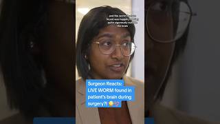 LIVE WORM In Patient's Brain?! Surgeon Reacts #shorts