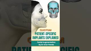 Custom Patient-Specific Implants Explained | Facial Augmentation by Dr Arun Panda
