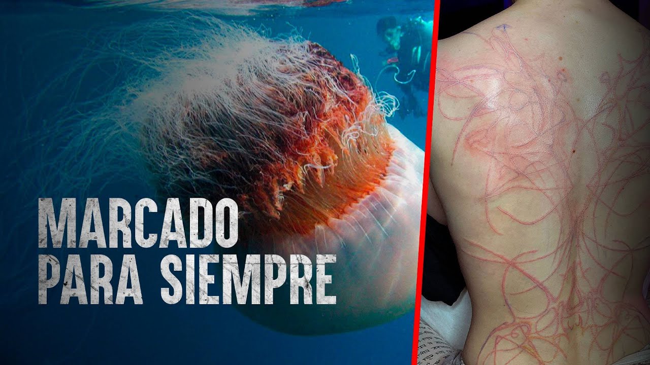 Cómo Sobrevivir las 10 medusas más venenosas - YouTube