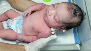 Newborn Baby Vomiting Management | NICU Recovery, Treatment & Good Condition screenshot 5