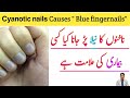 Bluish Purple Discoloration Of Nails Cyanotic Nails ناخن کا رنگ نیلا پڑنے کی وجہ اور علاج Bluish Purple Discoloration Of Nails Cyanotic Nails ناخن کا رنگ نیلا پڑنے کی وجہ اور علاج