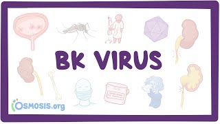 BK virus (Hemorrhagic cystitis) - causes, symptoms, diagnosis, treatment, pathology
