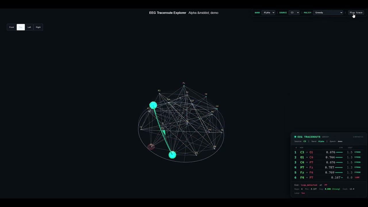 EEG Paradox TraceRoute
