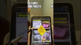 Grampeador p/ hemorroida com pelinhas: por que muitos pacientes continuam insatisfeitos #shortsvideo