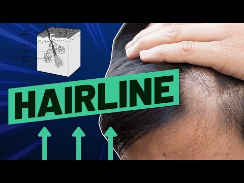 Uneven Hairline: How To Fix It And What Causes It