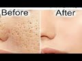 How to eleminate pores | easiest way | 2018 | paksiatni youtuber | its rimsha