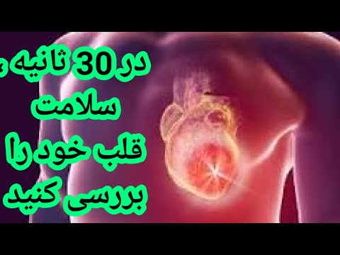 تصویری: نبض خود را بررسی کنید