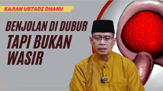 Benjolan Di Dubur Tapi Bukan Wasir - Kajian Ustadz Dhanu