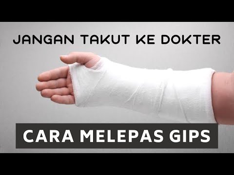 Video: Cara Melunakkan Gips Untuk Dilepas