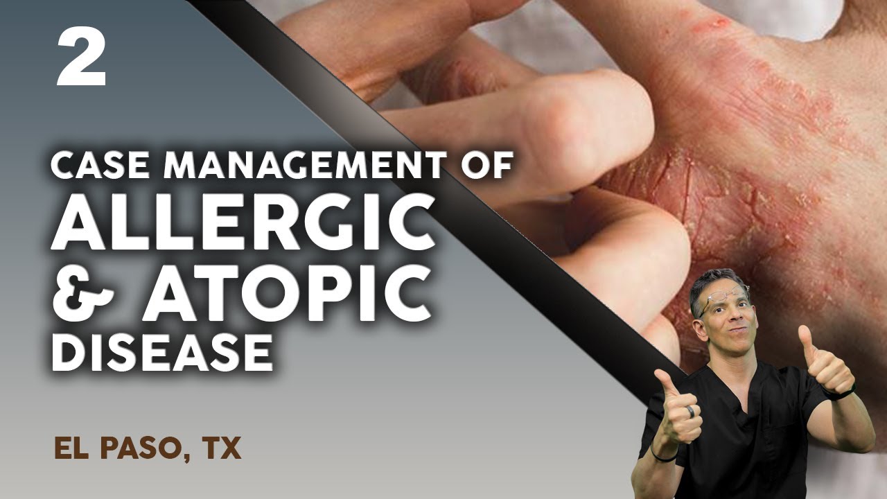 Case Management of Allergic and Atopic Disease | El Paso, Tx (2021) 2/3