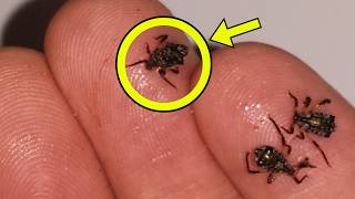 Famous Man Thought He Had "Bed Bugs" - Expert Stops Cold After Realizing What They Actually Are Net Worth
