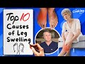 What Causes Leg Swelling? The Top Ten Reasons for Puffy or Swollen Legs!