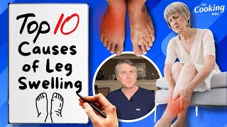 What Causes Leg Swelling? The Top Ten Reasons for Puffy or Swollen Legs!