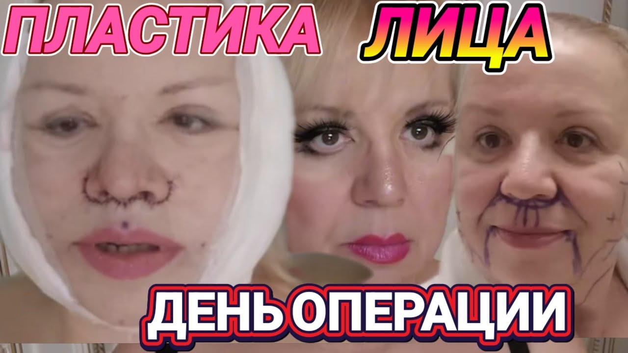 🔥Пластическая Операция!День Первый в Клинике 🔥ANACOSMA🔥