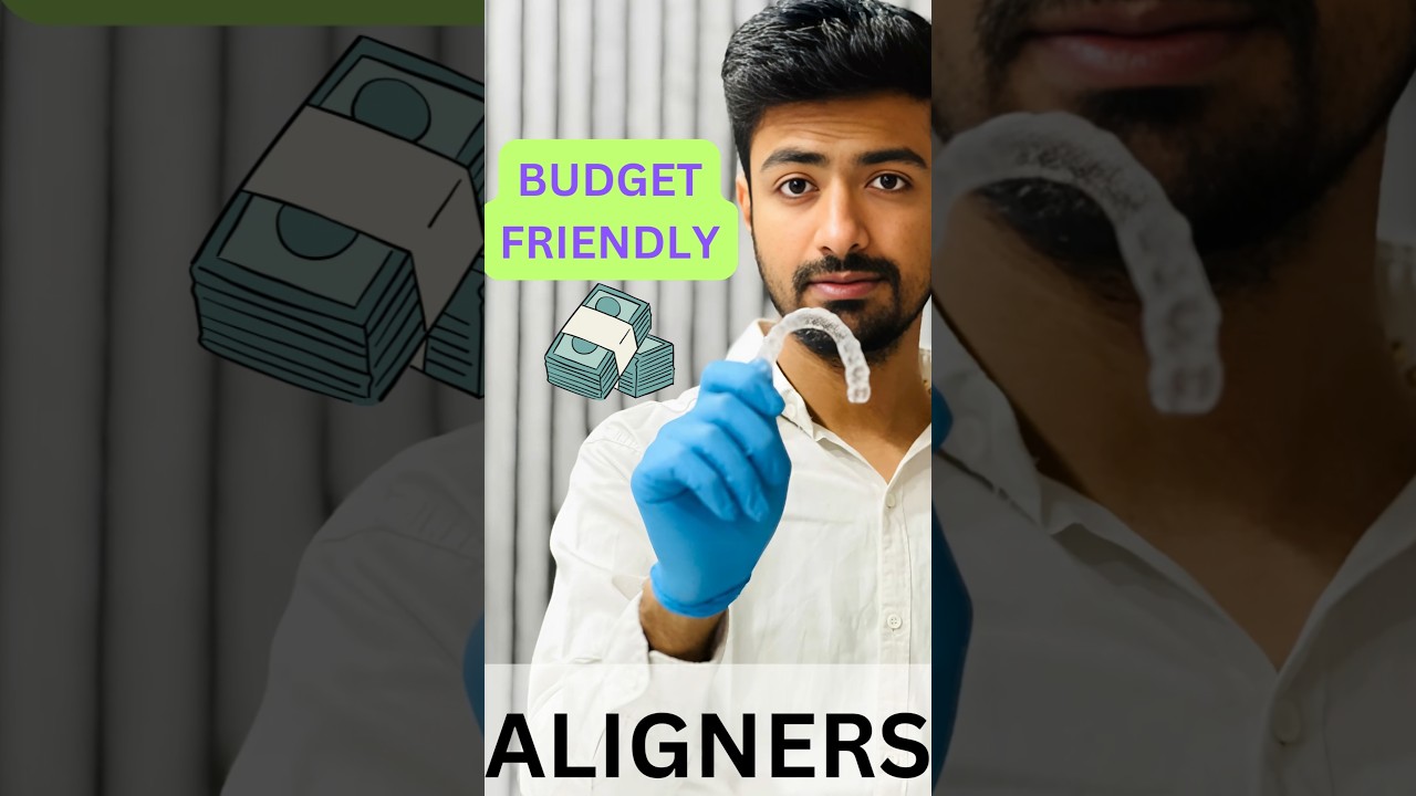 Are Aligners Costly? Budget friendly Aligners