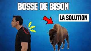 CORRIGER LA BOSSE DE BISON : EXPLICATION ET EXERCICE KINÉ