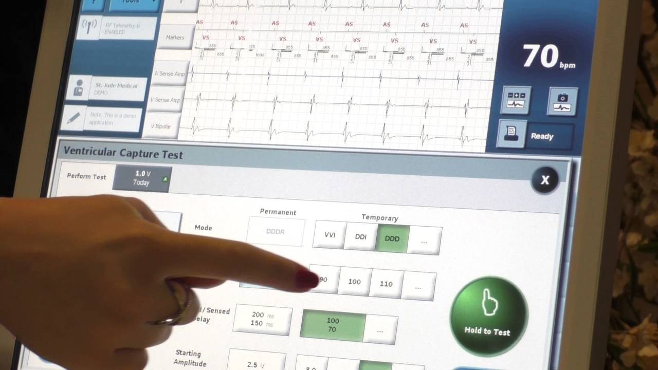 OLC - ICD programming Part 1