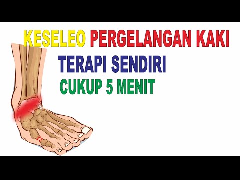 CARA MENGATASI KESELEO PERGELANGAN KAKI / ANKLE SPRAIN