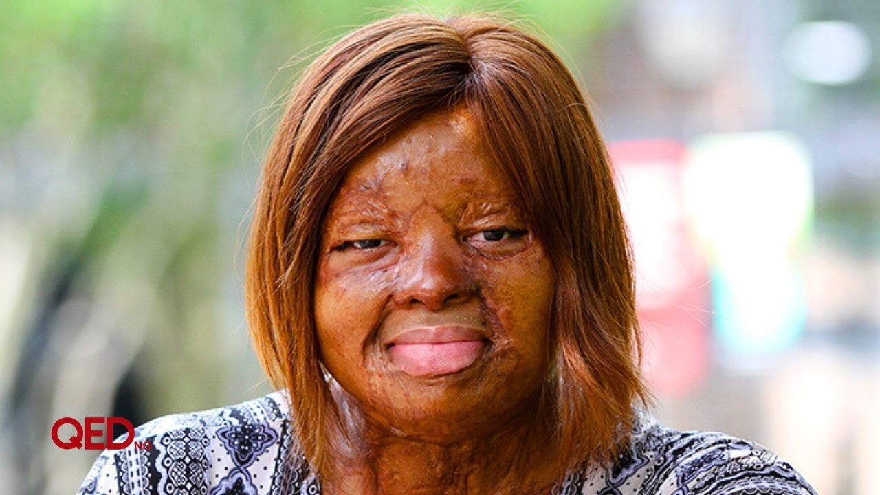 Sosoliso crash survivor Kechi Okwuchi dedicates self to living for victims