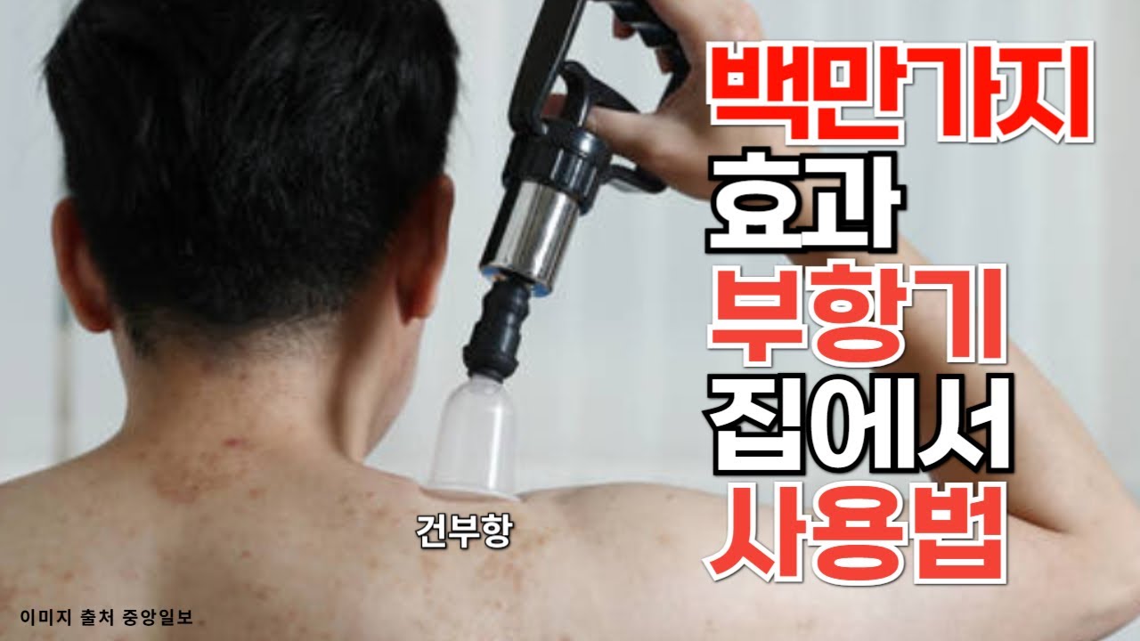 (유료광고 포함)효과 만점 집에서 부항기 사용법 ㅣ부항은 꼭 집에 마련해 두고 수시로 사용하면 아주 좋습니다 ㅣ 부항 치료 ...