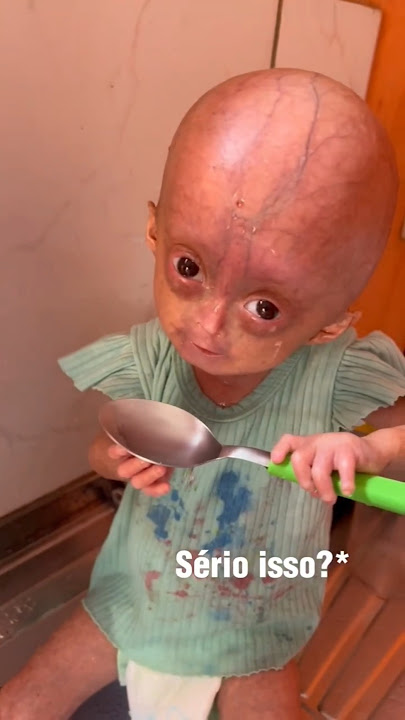 Love is Gone || God bless you || Sehat selalu yah dek #shorts #Respect #ytshorts