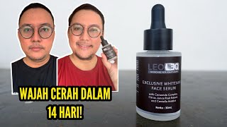 Download lagu Review Jujur Leoleo Exclusive Whitening Face Serum