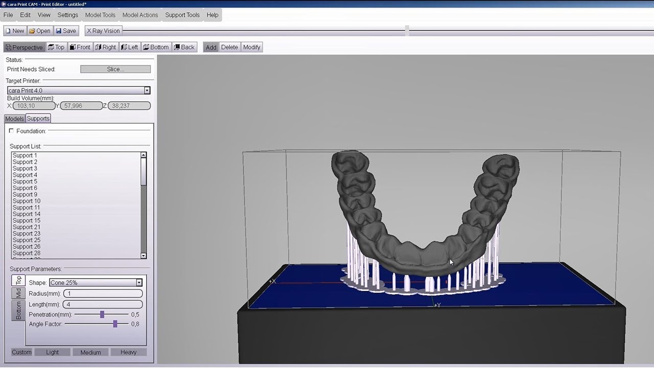 Ис кам. CAD cam 3d печать. 3д моделирование КАД Кам. CAD cam моделирование зубов. Моделирование вкладки в CAD cam.