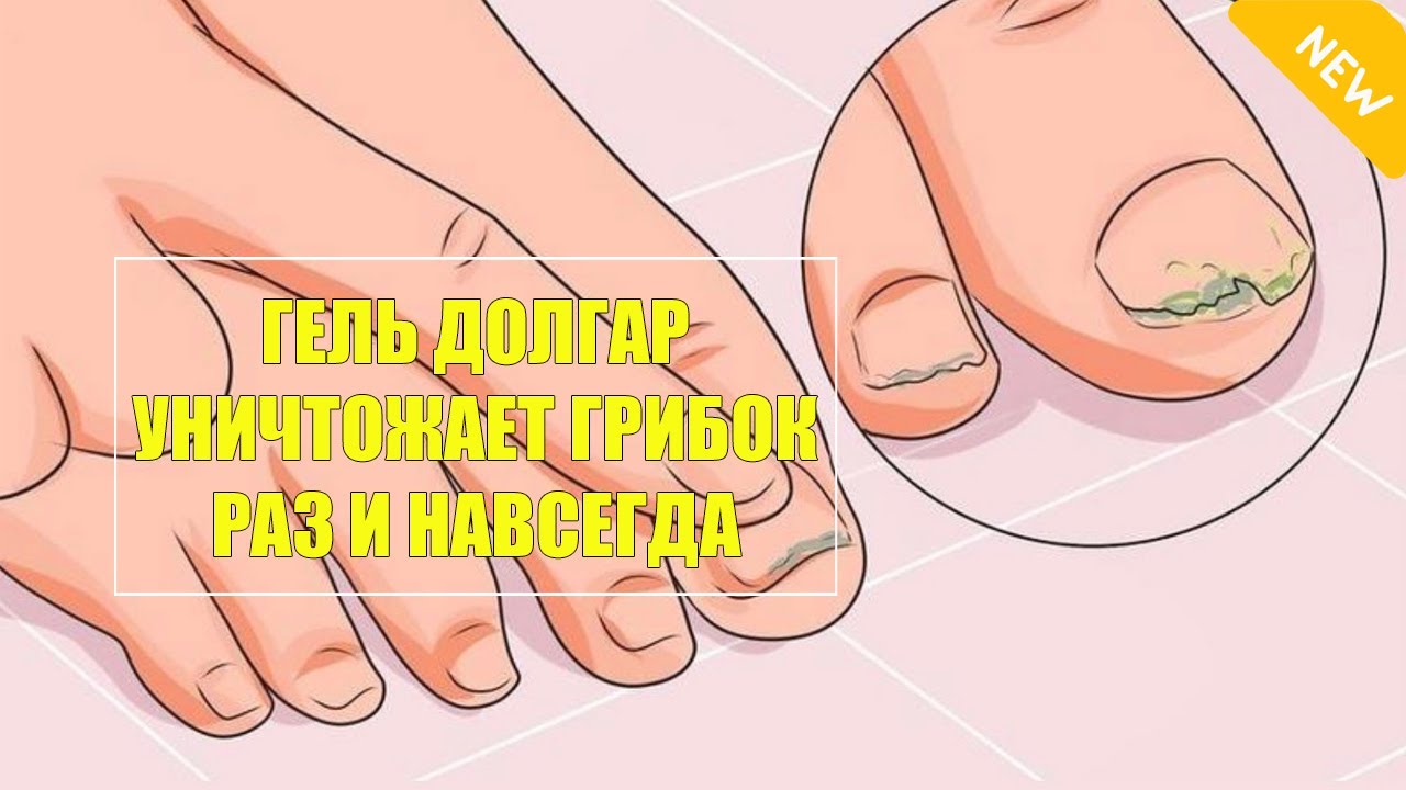 Мазь Диметилфталат От Грибка Цена В Аптеках