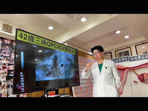 誰敢跟我蔡醫師打賭「一定雙胞胎」成功 真的懷孕成功！ 11/6看到一大小雙胞胎！ 真的雙胞胎！ 小的危險嗎？ 大小差這麼多？