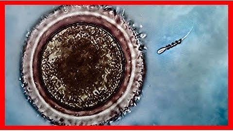 Video: motorized ‘spermbot’ helps sperm reach egg