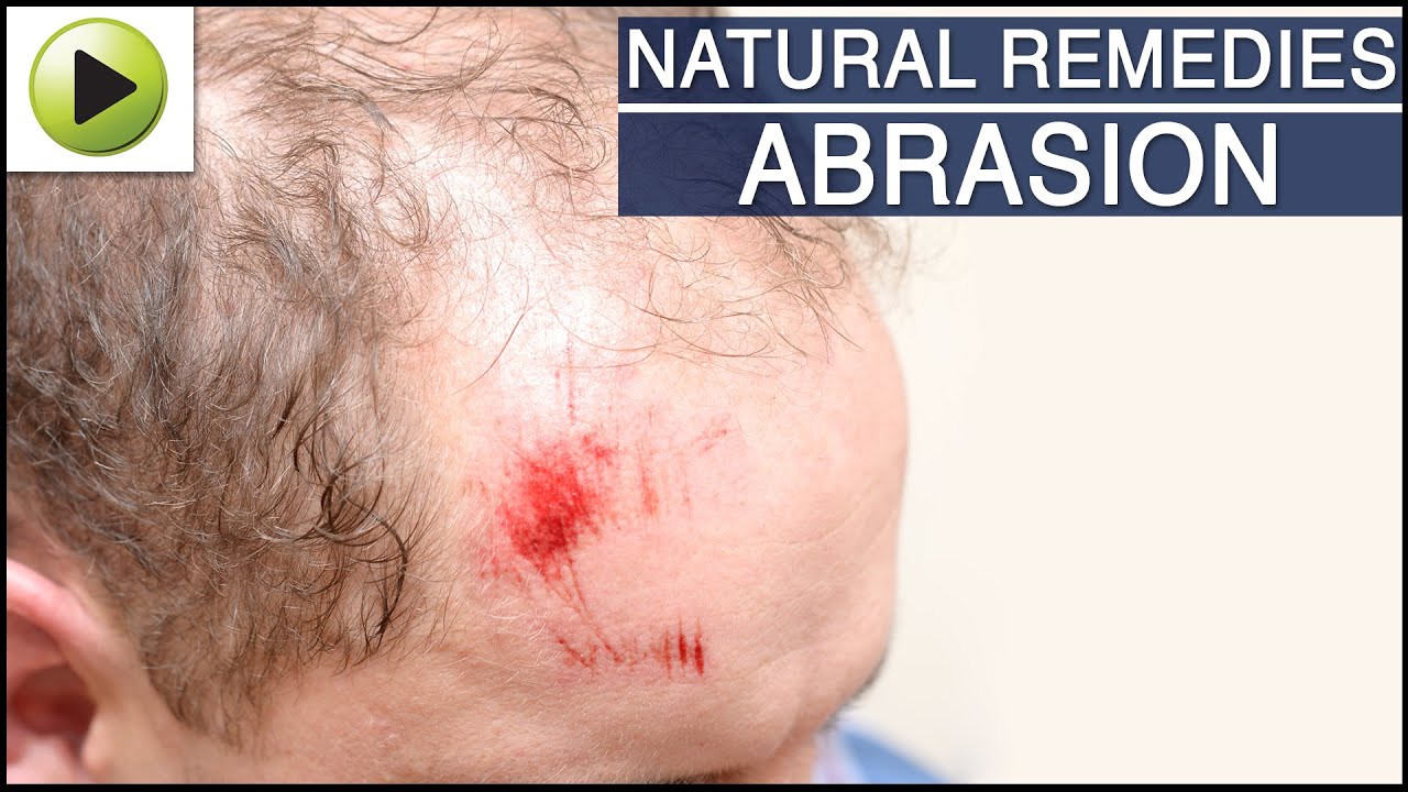 Natural Home Remedies For Wound Care Natural Home Remedies For Wound Care