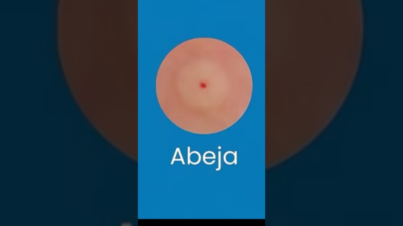 Así son las picaduras de diferentes insectos 