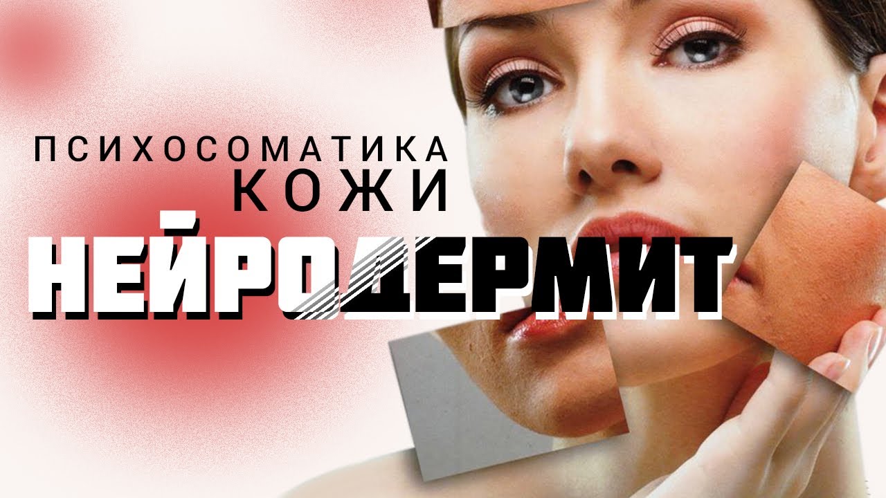 Нейродермит | #психосоматика кожи | психолог Светлана Радужка - YouTube
