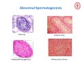 Grand Rounds- Male Infertility