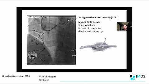 IMDS EuroCTO 2020 - New techniques and versatility of the ReCross dual lumen micro catheter
